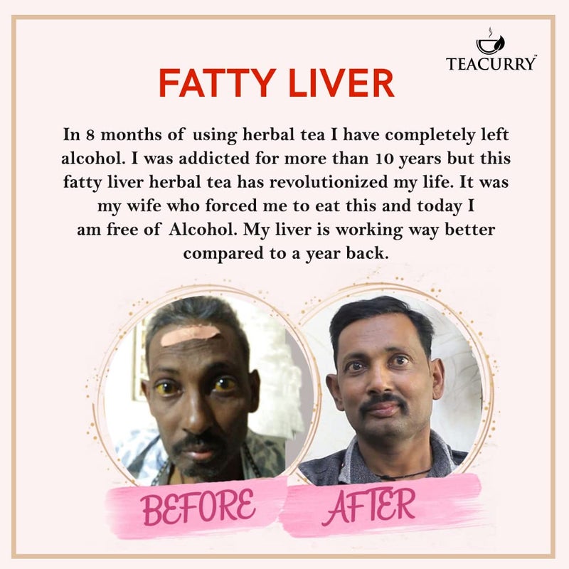 TEACURRY Fatty Liver Tea (1 Month Pack | 100 Gms Loose + Infuser) - Helps with Abdominal Swelling, Ascites, Enlarged Vessels - Image 2