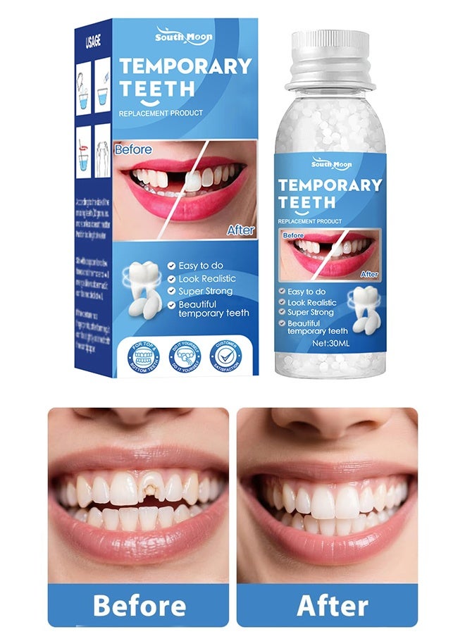 SOUTH MOON Tooth Repair Kit - Teeth Replacement Kit for Temporary Restoration of Missing & Broken Teeth Replacement Dentures, DIY Heat Fit Beads - Image 1