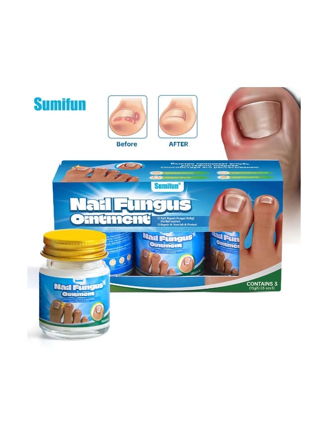 Sumifun كريم إصلاح فطريات الأظافر الاحترافي بتقنية الامتصاص السريع لتخفيف الألم، وتقليل الاصفرار، واستعادة قوة الأظافر، وتوفير حماية كاملة للأظافر اليومية لكل من الأظافر اليدوية والقدمية - Image 1