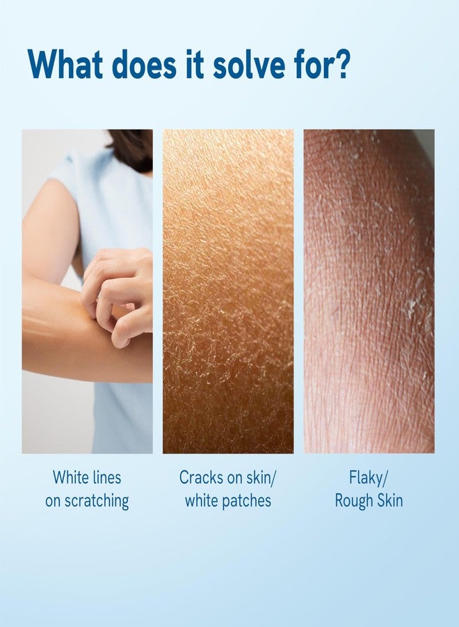 Be Bodywise Bodywise Be 10% Urea Body Lotion 200ml | 48 Hour Dry Skin Relief | For Very Dry & Flaky Skin | With Ceramides, Kokum & Mango Seed Butter | Non-Greasy & Lightweight Formula - Image 2