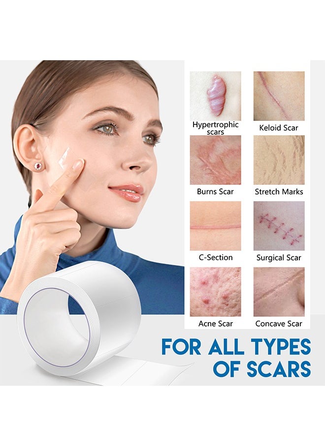 Elaimei - Clear Silicone Scar Sheets (0.98”x 59”, 1.5M), Transparent Silicone Scar Strips, Effective Scars Away, Invisible Silicone Scar Sheets For Surgical Scars, C-Section Surgery Scar, Keloid, Burn, Acne - Image 1