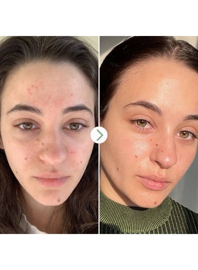Pai Skincare Carbon Star Detoxifying Overnight Face Oil 30ml - Image 3