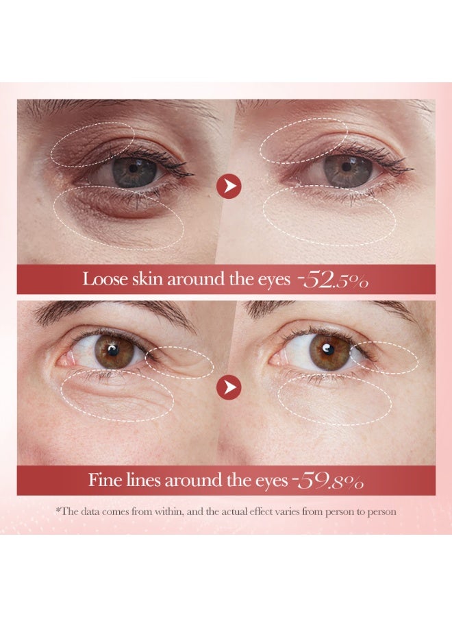 BIOAOUA Snail Moisturizing Eye Cream - Image 4