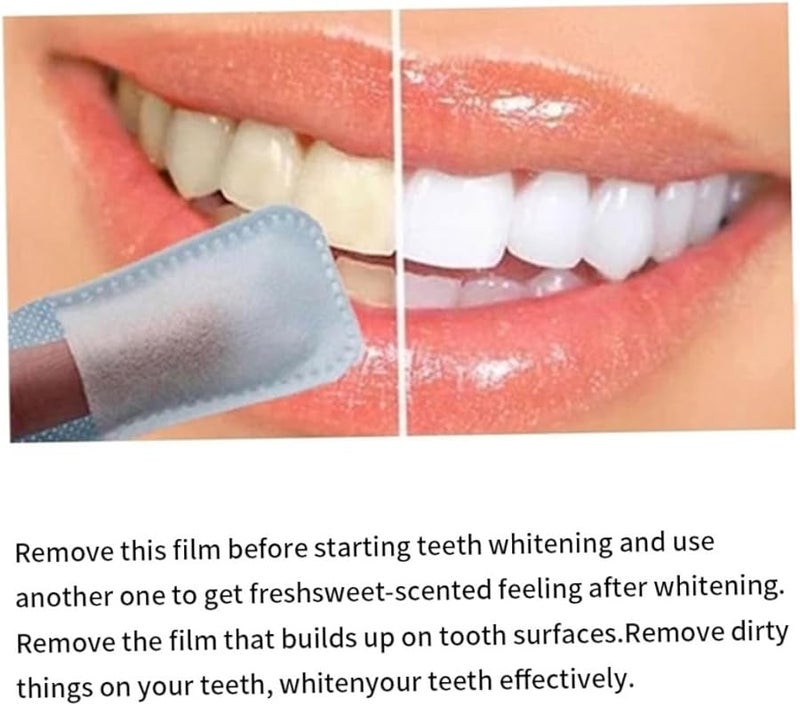 مناديل تنظيف الأسنان نيدون 50 قطعة فرشاة أسنان للأصابع لتفتيح الأسنان والعناية بالنظافة - Image 5