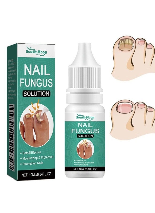 SOUTH MOON - Nail Fungus Solution 10ml, Brighten onychomycosis, Restores Appearance of Discolored or Damaged Nails, Hydrate and Exfoliate Brittle Nails, Anti Fungal Nail Treatment - Image 1