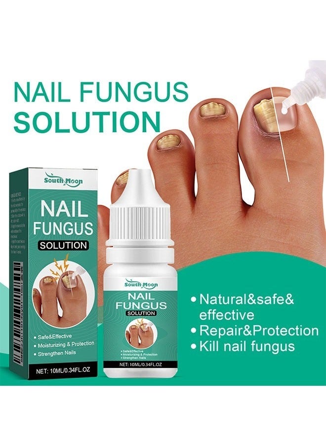 SOUTH MOON - Nail Fungus Solution 10ml, Brighten onychomycosis, Restores Appearance of Discolored or Damaged Nails, Hydrate and Exfoliate Brittle Nails, Anti Fungal Nail Treatment - Image 1