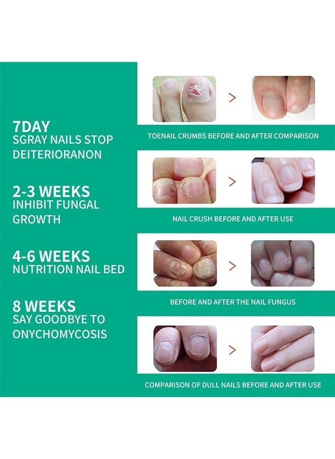 SOUTH MOON - Nail Fungus Solution 10ml, Brighten onychomycosis, Restores Appearance of Discolored or Damaged Nails, Hydrate and Exfoliate Brittle Nails, Anti Fungal Nail Treatment - Image 1