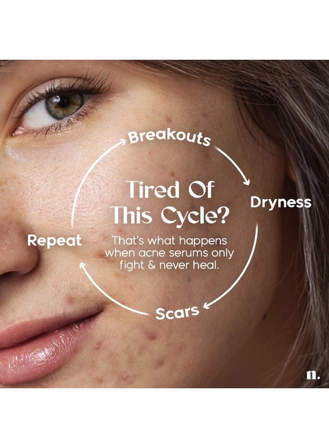 Numour No Breakouts Tonight| Dual Acne face Serum 20ml | 8% Actives 2% Encapsulated Salicylic + 4% Niacinamide + Azelaic Acid & Zinc | Acne‑Prone & Sensitive Skin - Image 2