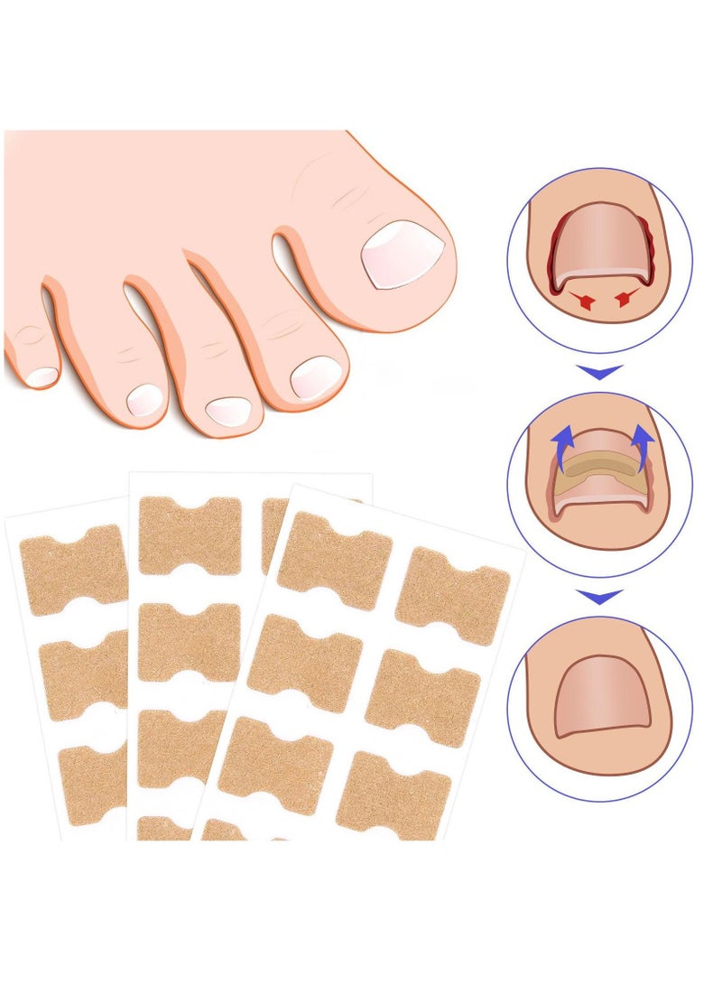 Sefudun 100 Pieces Ingrown Toenail Correction Stickers Toenail Corrector Patch Glue-free Ingrown Toenail Corrector Strips Toenail Correction File Patches Relieve Nail Groove Unisex - Image 3