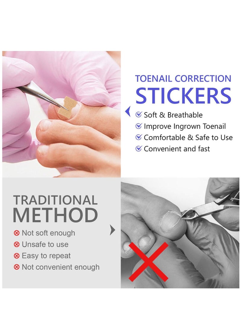 Sefudun 100 Pieces Ingrown Toenail Correction Stickers Toenail Corrector Patch Glue-free Ingrown Toenail Corrector Strips Toenail Correction File Patches Relieve Nail Groove Unisex - Image 2