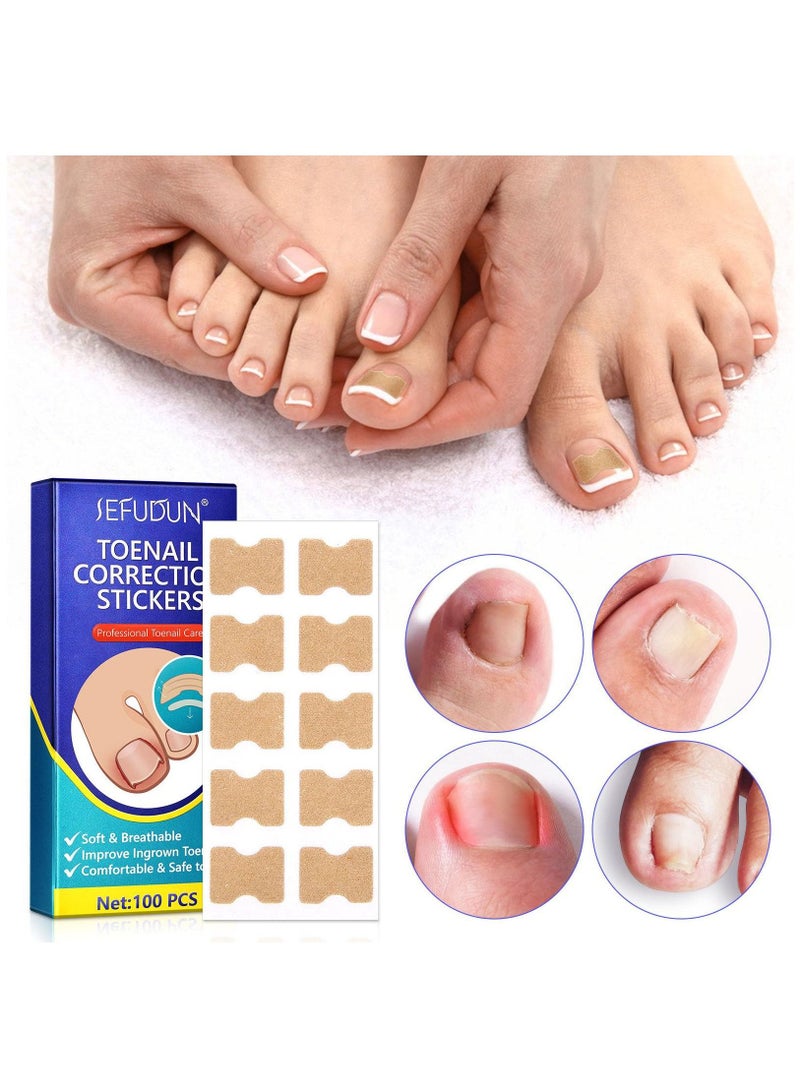 Sefudun 100 Pieces Ingrown Toenail Correction Stickers Toenail Corrector Patch Glue-free Ingrown Toenail Corrector Strips Toenail Correction File Patches Relieve Nail Groove Unisex - Image 1
