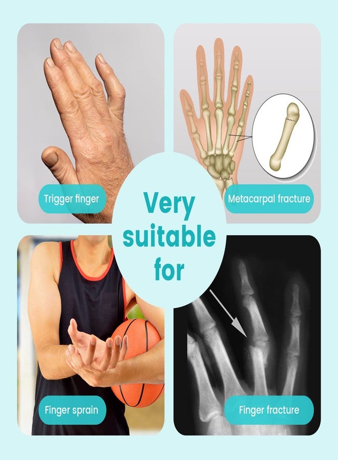 DrFinger Broken Finger Splint Brace for Trigger Finger,Injured, Arthritis Pain, Adjustable Brace with 2 Aluminum Plate (2-Fingers) - Image 2