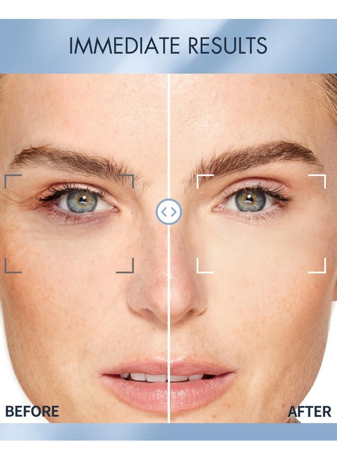 depology Replenish & Repair Under Eye Patches for Puffy Eyes, Wrinkles (60 Patches) | Hydrating with Ceramides and Hyaluronic Acid for All Skin Types | Botanical Extracts Eye Gel Pads 2.96 fl oz - Image 4