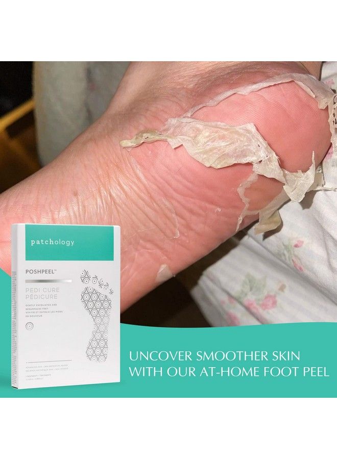 Patchology Poshpeel Pedi Cure Foot Peel Mask Soak Treatment Pedicure Foot Spa Feet Peeling Mask Pedicure Booties W Deep Exfoliation For Babysoft Skin Pedicure Supplies For Foot Care 1 Pair - Image 5