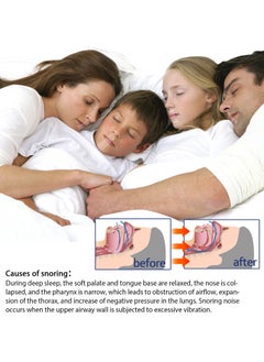 SOUTH MOON Snoring Adhesive Tape 9 Meters For Adults And Children  - Image 5