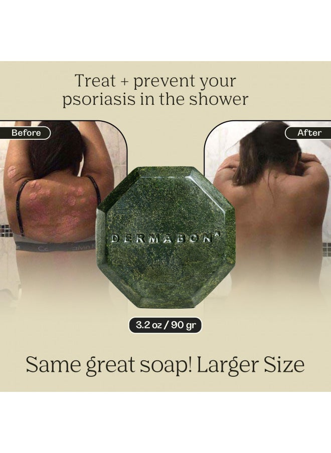DERMABON - Dermabon Psoriasis, Dermatitis & Dandruff Control soap bar with 2% Coal Tar as its Active Ingredient - 1 Pack - Image 1