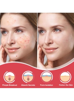 BTFMEI 36 Pieces Hydrocolloid Acne Cover Patches, Invisible Makeup Closed Acne Patch, Effective for Blackheads, Whiteheads and Closed Comedones  - Image 2