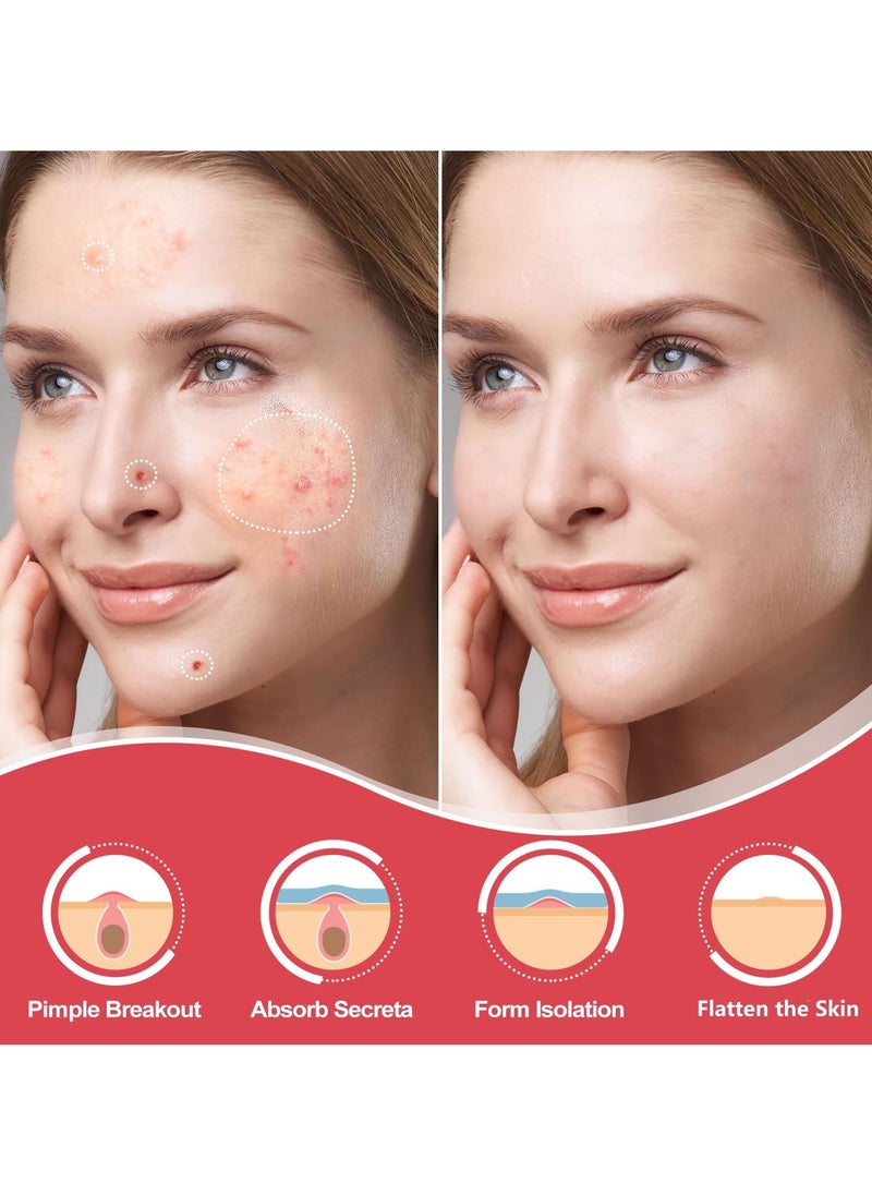BTFMEI 36 Pieces Hydrocolloid Acne Cover Patches, Invisible Makeup Closed Acne Patch, Effective for Blackheads, Whiteheads and Closed Comedones  - Image 2