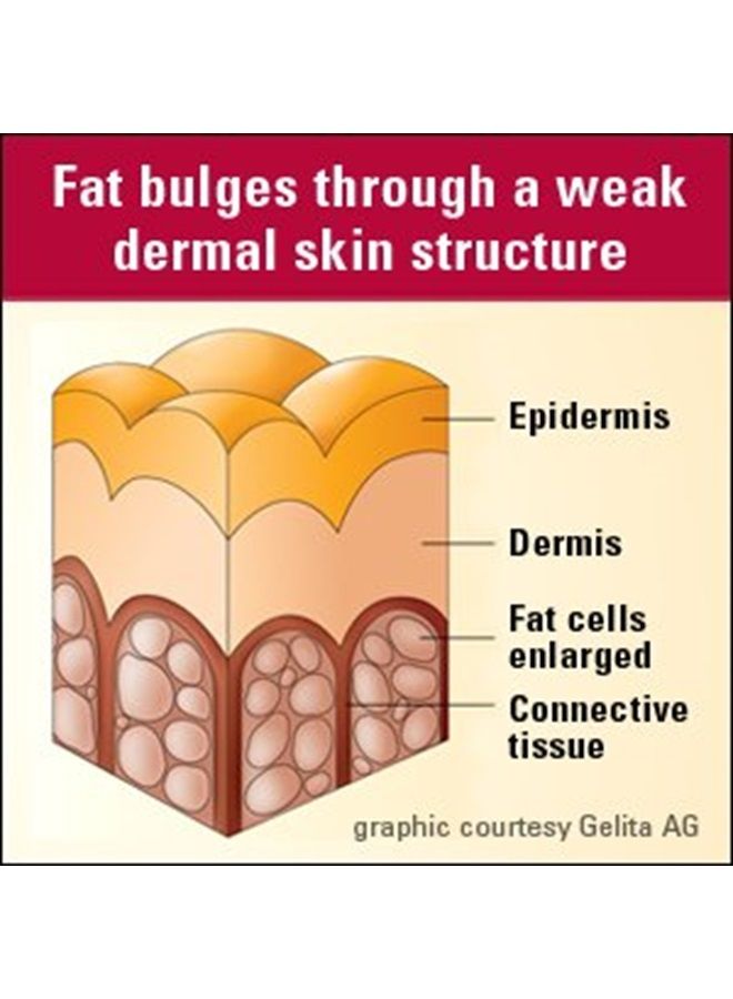 Lindberg Collagen Peptides Supplements | 270 Tablets | for Hair, Skin, and Nails | Skin Rejuvenator with Verisol - Image 5