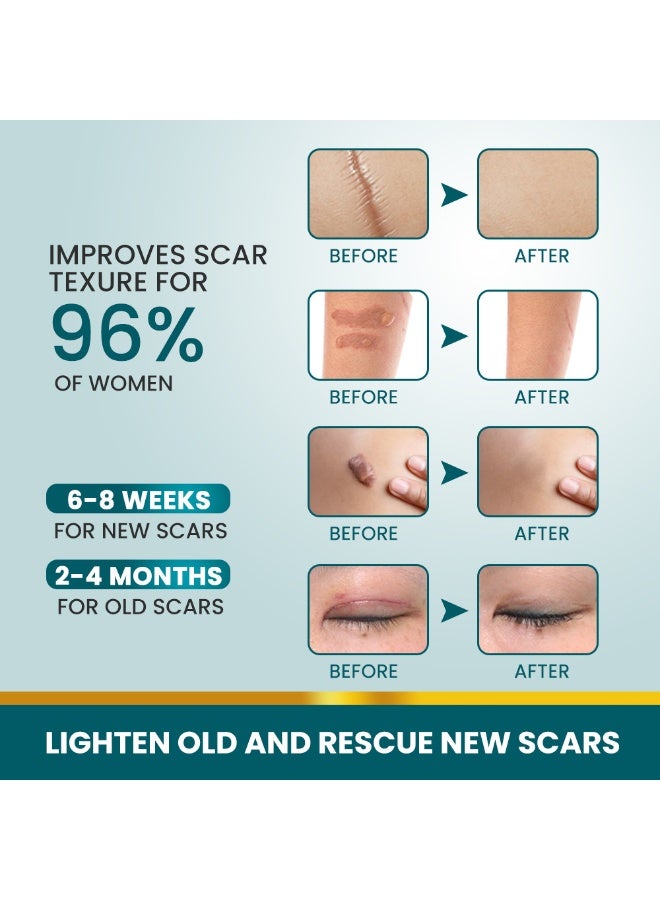 سوميفون شريط جروح سيليكون من سوميفون، لاصق لتقليل الندوب، إزالة فعالة للندوب، ذاتي اللصق، لإصلاح الحروق وحب الشباب، سيليكون ناعم - Image 3