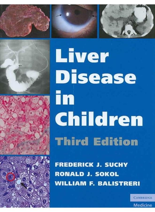 أمراض الكبد عند الأطفال