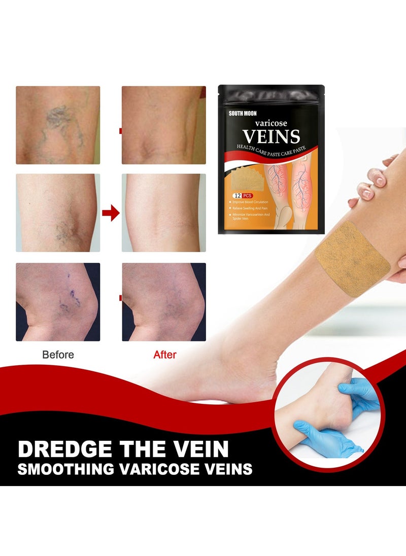 SOUTH MOON 3-PACK Vein Soothing Health Patch, Reduce Varicose Veins, Relieve Swelling And Pain 12pcs*3  - Image 3