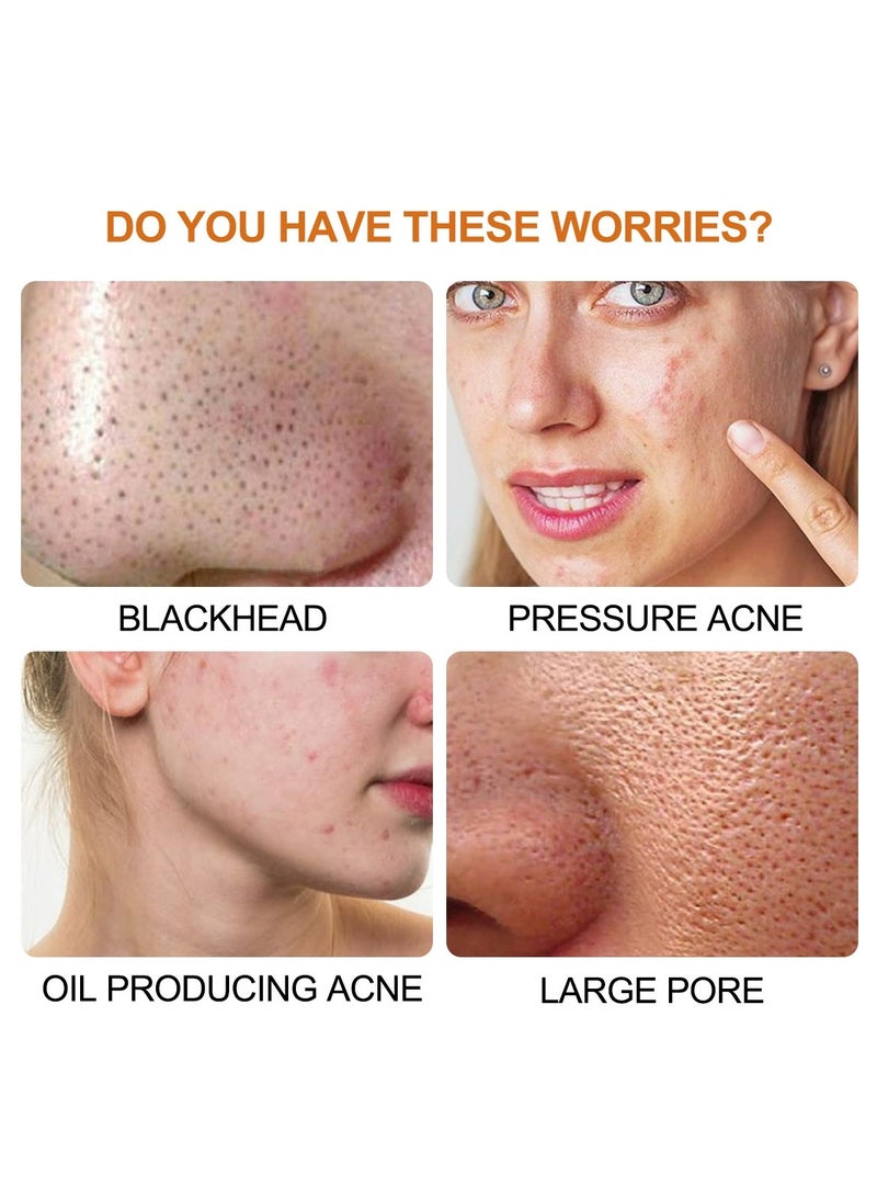 LANEMAY Hydrogel Nose Strips Blackhead Remover – Pore Cleansing Peel-Off Nose Mask, Oil-Control Deep-Cleaning Blackhead Patch - Image 4