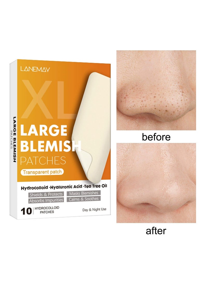 LANEMAY Hydrogel Nose Strips Blackhead Remover – Pore Cleansing Peel-Off Nose Mask, Oil-Control Deep-Cleaning Blackhead Patch - Image 1