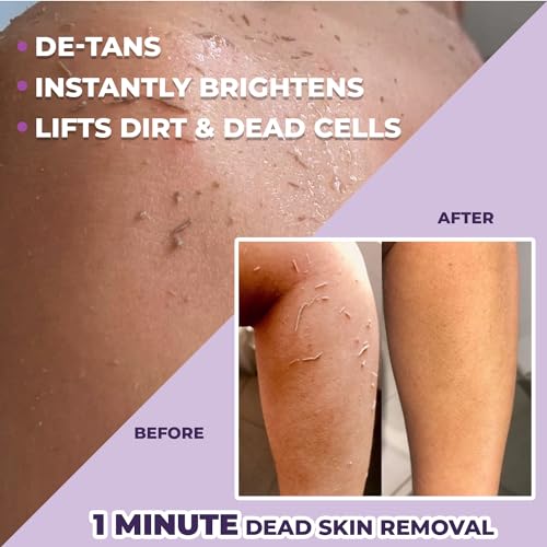 Sanfe Instant Tan & Dead Skin Removal Exfoliating Gel | Visibly Removes Tan | AHA Exfoliation in Minutes | Smooth & Bright Skin | 200g - Image 3
