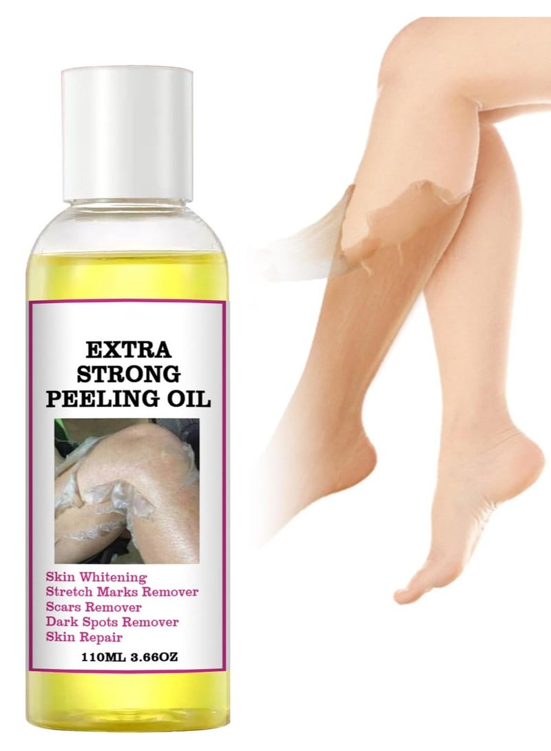 OUHOE زيت تقشير أصفر، زيت تقشير للبشرة الداكنة، زيت تقشير قوي بتركيز إضافي، محلول تقشير مقشر للجسم لجميع أنواع البشرة مزيل للجلد الميت - Image 1