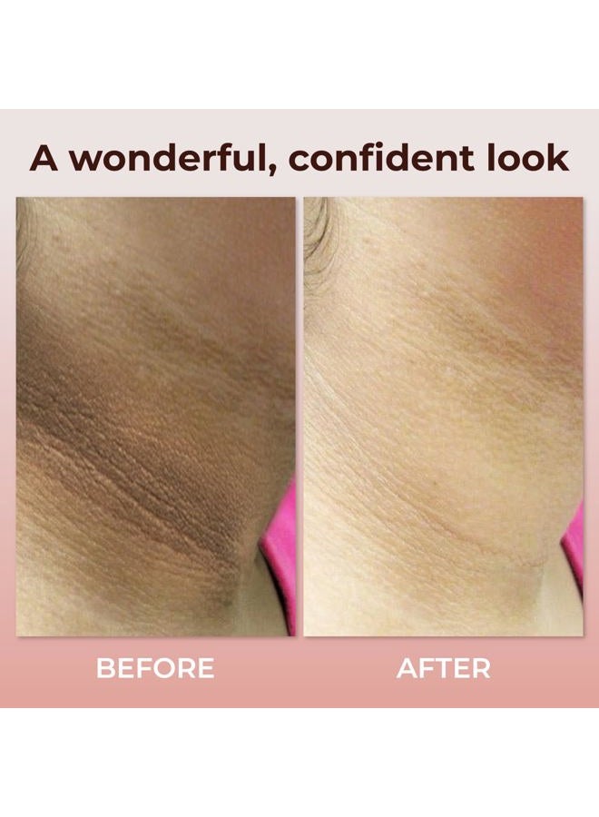 ABERA Loka Nano Collagen Neck Cream, Acanthosis Nigricans Treatment for Neck & Décolleté, Dark Neck Remover Underarm, Private Parts, SPF 30+, Reduce Fine Lines & Wrinkles with Niacinamide (1.76 Fl Oz) - Image 3