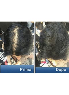 pantogar Pantogar (Pantovigar) Specific Treatment for Hair and Nails - 90 Cap  - Image 5