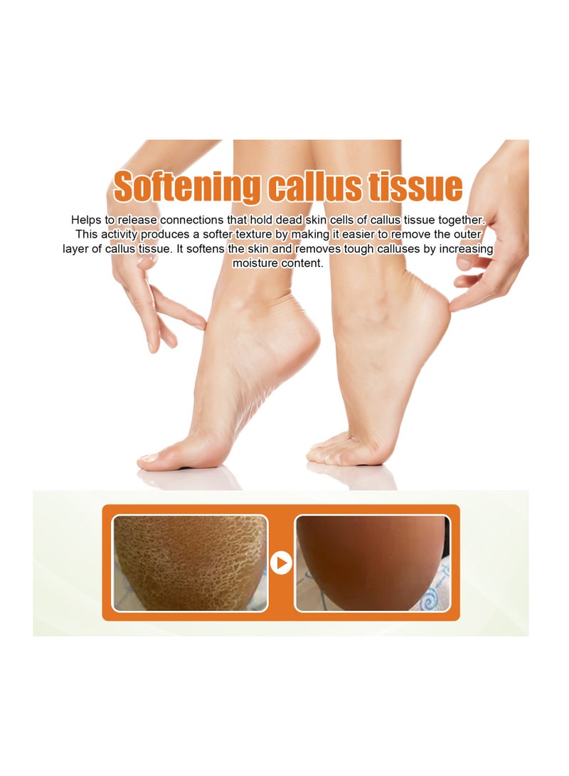 SOUTH MOON Foot Callus for Remove Dead Skin From Soles of Feet and Repair Feet  - Image 3
