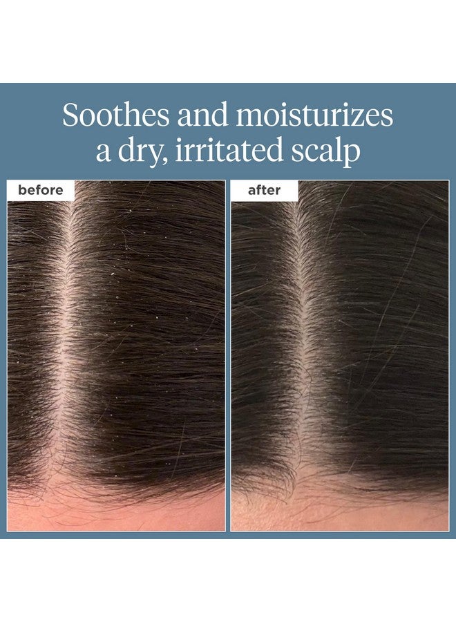 بريوجيو زيت بريوجيو سكالب ريفايفال روزماري قبل الغسيل، للشعر وفروة الرأس، علاج لفروة الرأس الجافة لشعر أقوى وأطول، يهدئ فروة الرأس الجافة، الدهون والفيتامينات، ترطيب عميق، نباتي، خالٍ من القسوة، 3.4 أونصة سائلة - Image 2