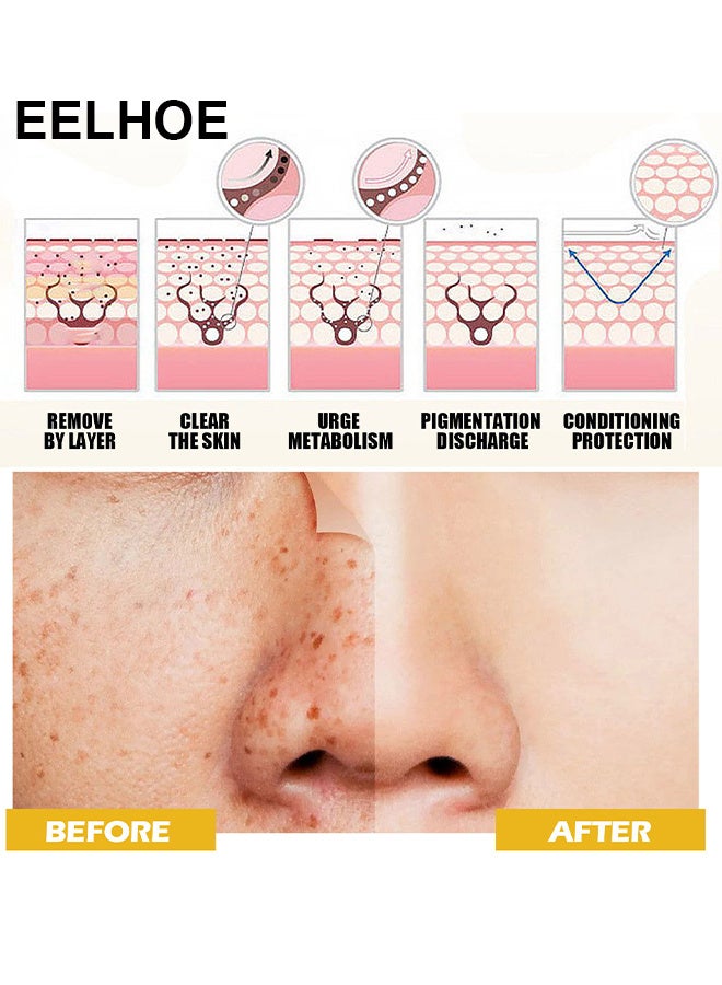 إيلهو تونر الوجه بخلاصة الكركم 100٪ ، تونر تصحيح البقع الداكنة للوجه ، يقلل من فرط التصبغ ، بقع الشيخوخة المضادة للشيخوخة بقع الشيخوخة ، بقع الشمس ويحسن لون البشرة ، يهدئ البشرة وينعمها - Image 4