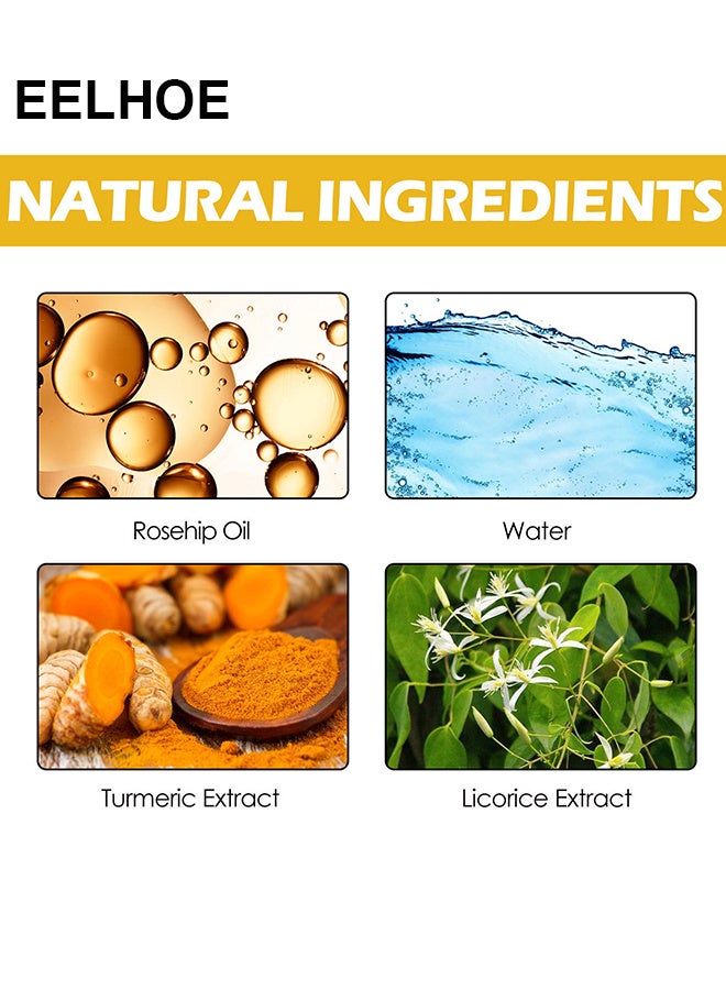 إيلهو تونر الوجه بخلاصة الكركم 100٪ ، تونر تصحيح البقع الداكنة للوجه ، يقلل من فرط التصبغ ، بقع الشيخوخة المضادة للشيخوخة بقع الشيخوخة ، بقع الشمس ويحسن لون البشرة ، يهدئ البشرة وينعمها - Image 3