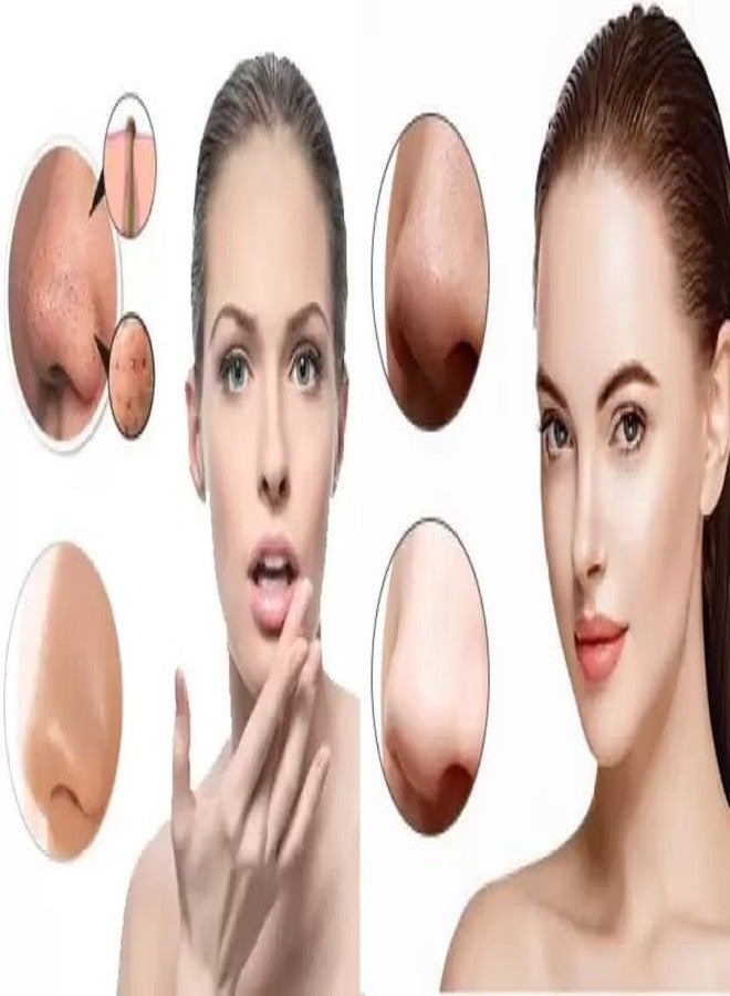 Lui Pui LUIPUI Paper Blackhead Remover Strips (Pack of 10) - Image 4