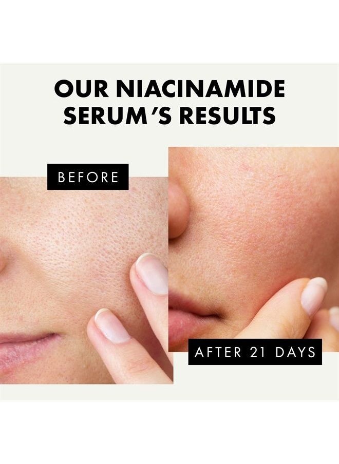 Eclat Skincare Niacinamide Serum for Face 20% - Firming, Hydrating, Brightening Serum with Zinc & Hyaluronic Acid for All Skin Types - Reduces Wrinkles, Pores, Hyperpigmentation - Dermatologist Developed, 30ml  - Image 3