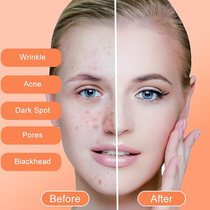 LOPHE Pure Kojic Acid Skin Brightening Soap3100g Soap Bar for Deep Facial Body Skin Cleaning with A Foaming Net Face and Body Bar for Skin Moisturizing Improve Uneven Skin Tone Gently Healing Acnes - Image 3