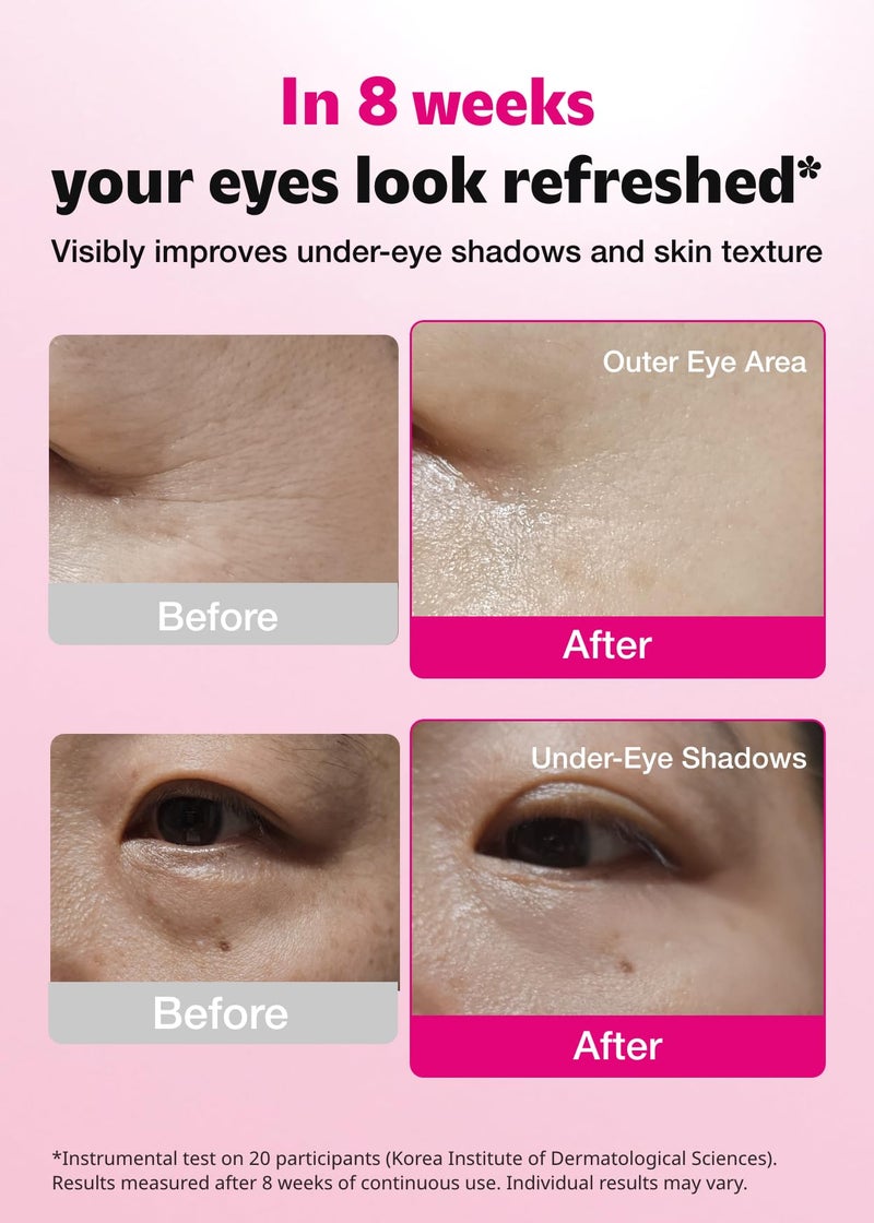 ISOI Blemish Care Under Eye Patch for Dark Circles, Puffiness and Wrinkles, Hydrating Gel Eye Masks with Hyaluronic Acid & Bulgarian Rose Oil, Korean Skin Care (90 pcs, 3.17 oz) - Image 3