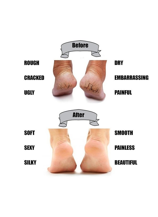 Jiya Enterprise - Gel Heel Socks For Heel Swelling, Pain Relief, Dry Hard Cracked Heel Repair Cream, Foot Care Ankle Support Gel Pad For Unisex - Image 1