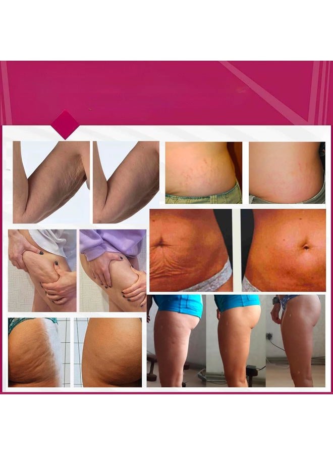 Anacis Anti-Cellulite Advanced Hot Body Cream Gel For Even Skin and Elasticity 5.07 Oz - Image 5