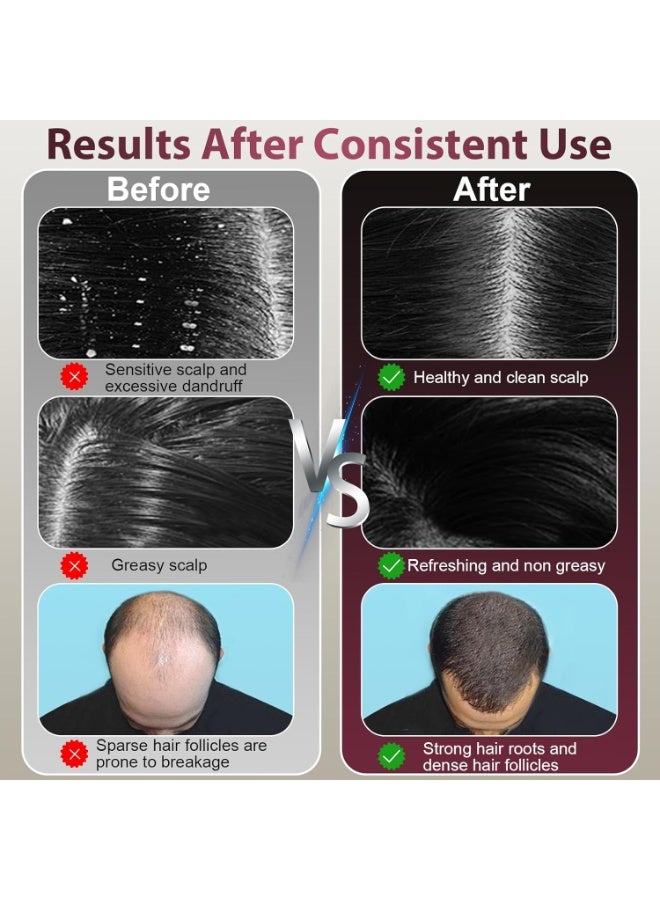 كيلا جهاز تدليك فروة الرأس 3 في 1، أداة توزيع زيت نمو الشعر، فرشاة كهربائية لفروة الرأس للاستخدام المنزلي، جهاز تدليك كهربائي للرأس مقاوم للماء بدرجة IPX7 - Image 3