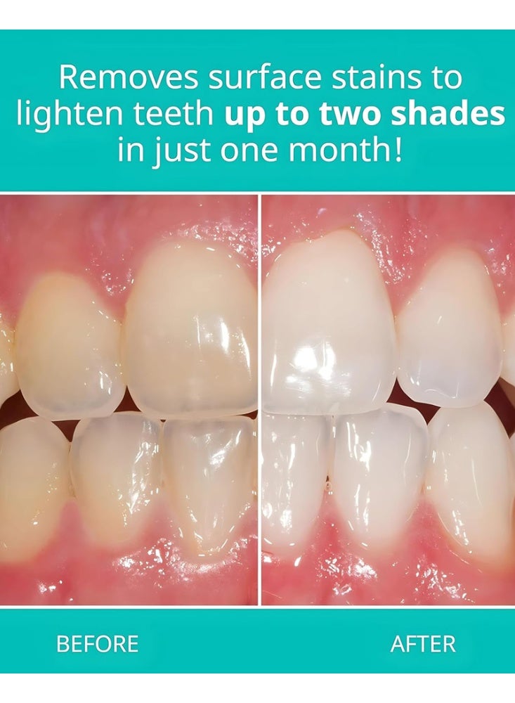 Opalescence Whitening Toothpaste Fluoride Cool Mint 133 g (4.7 oz) - Image 2