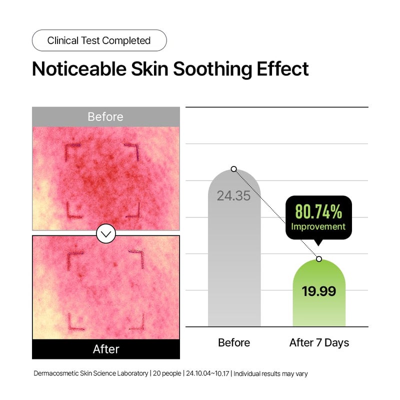 Parnell Panthenol 3.89% | 50ml / 1.69 fl.oz. | Heartleaf Calming Capsule Cream, Acne soothing cream, korea skin care, korea beauty - Image 4