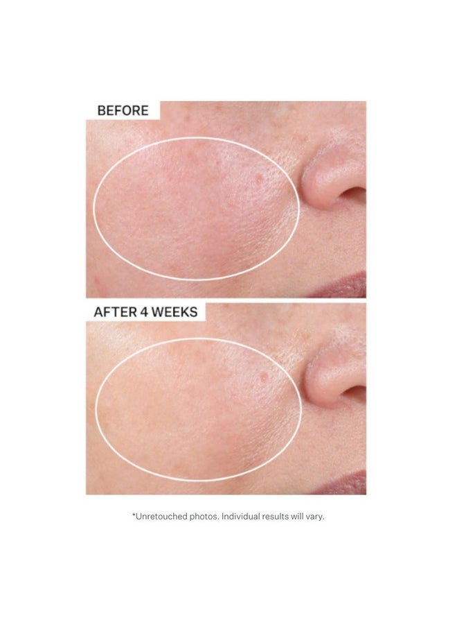 Strivectin StriVectin Advanced Retinol Intensive Night Moisturizer, Targets Visible Signs of Aging for Healthier Skin, 1.7 Fl Oz  - Image 4