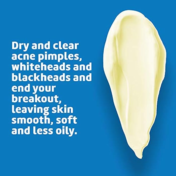 De La Cruz Sulfur Ointment - Cystic Acne Treatment for Face and Body - Daily 10 Min Spot Treatment Mask - Safe and Effective Game Changing Hormonal Acne Treatment that Clears Up Pimples - 2.6 OZ Tube - Image 4