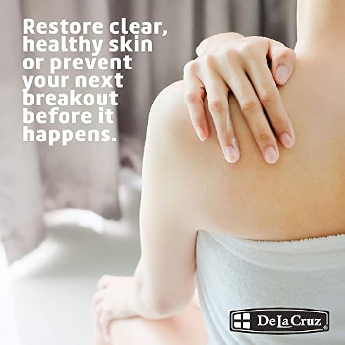 De La Cruz Sulfur Ointment - Cystic Acne Treatment for Face and Body - Daily 10 Min Spot Treatment Mask - Safe and Effective Game Changing Hormonal Acne Treatment that Clears Up Pimples - 2.6 OZ Tube - Image 3