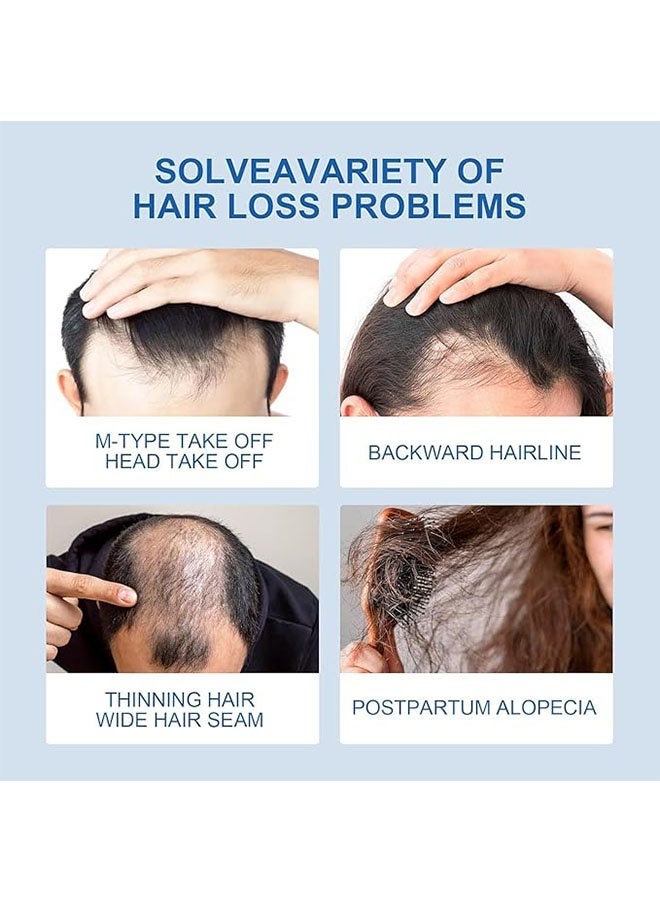 هويغوا Minoxidil 5٪ رش نمو الشعر مصل 120 مل, تحفيز نمو الشعر, إعادة تنشيط البصيلات, Minoxidil استخراج المصل لتساقط الشعر, استعادة اللحية للرجال والنساء - Image 2