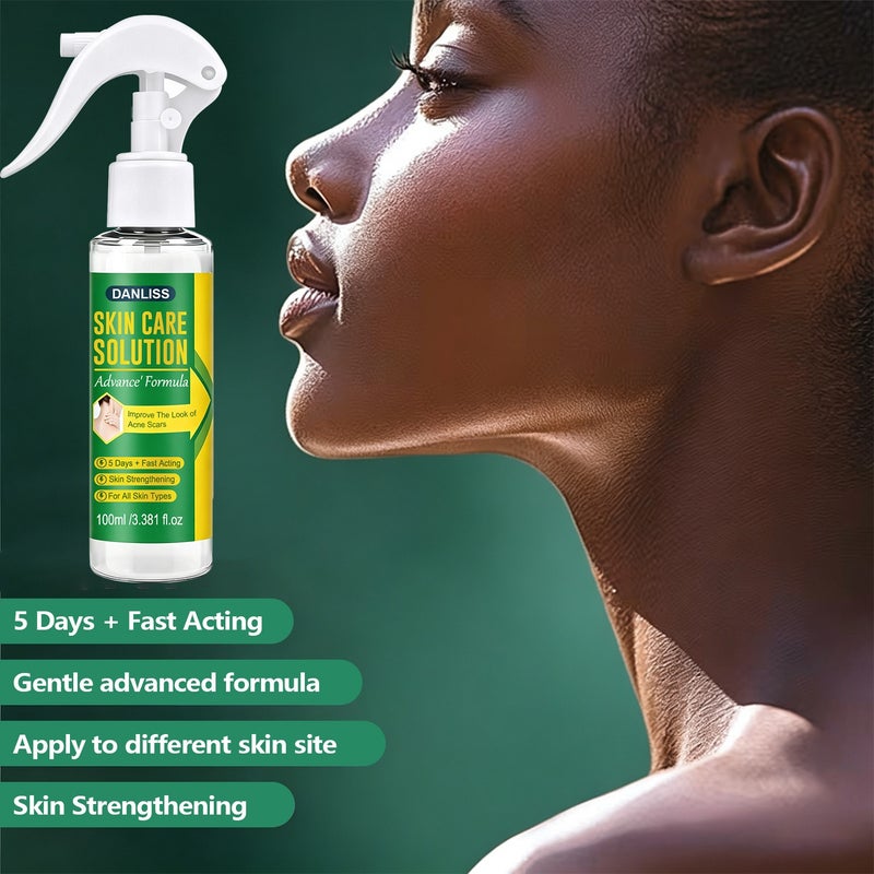 دانليس Danliss Advanced Acne Scar Repair Spray 100ml - يتلاشى بسرعة احمرار وندبات حب الشباب الداكنة في 5 أيام، ويعزز حاجز البشرة - Image 2